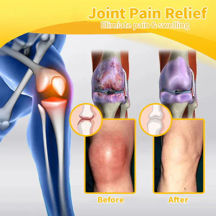 ✅Official Store: LOVILDS™ Bees Pain-Relief Bone Healing Cream👨⚕️USA Osteopathic Medical Association (AAOS)Approved(Reducing joint swelling, pain, stiffness, redness, warmth, soreness, and joint fatigue)