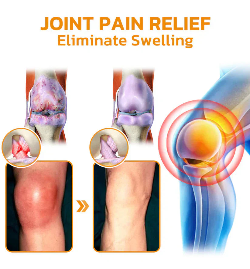 ✅Official Store: LOVILDS™ Bees Pain-Relief Bone Healing Cream👨⚕️USA Osteopathic Medical Association (AAOS)Approved(Reducing joint swelling, pain, stiffness, redness, warmth, soreness, and joint fatigue)