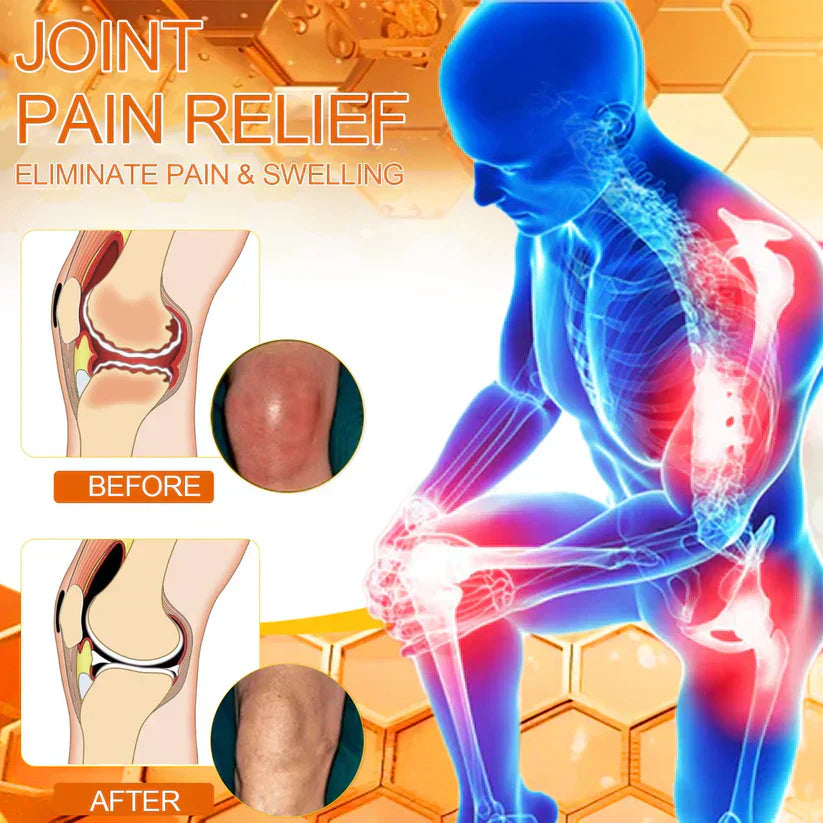 ✅Official Store: LOVILDS™ Bees Pain-Relief Bone Healing Cream👨⚕️USA Osteopathic Medical Association (AAOS)Approved(Reducing joint swelling, pain, stiffness, redness, warmth, soreness, and joint fatigue)