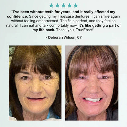 NESLEMY™🦷 𝗔𝗱𝘃𝗮𝗻𝗰𝗲𝗱 𝗖𝘂𝘀𝘁𝗼𝗺𝗶𝘇𝗲𝗱 𝗙𝘂𝗹𝗹 𝗗𝗲𝗻𝘁𝘂𝗿𝗲 𝗦𝗲𝘁 🦷 (Clinically backed comfort-fit dentures — trusted by over 8,000 users across the U.S.)